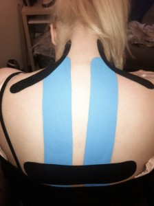 Kinesio Tape - Mid back, upper back, and neck strain due to postural syndrome - Pregnancy Issues